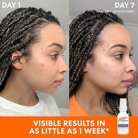 Palmers Skin Success Extra Strength Suero Corrector de Tono, Ayuda a Reducir Manchas Oscuras y Manchas de la Edad, Marcas Post-Acn, Apto para Todo... 