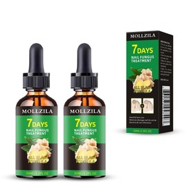 Mollzila Ginger Nail Treatment for Nail Support and Care - Nail Polish and Art Manicure Moisturize Care Daily Comfort  Daily Cuticle Strengthening - Specification: 2 (Half price for the second item)