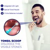 LED Tonsil Stone Remover | Bad Breath Cure | Easily