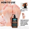 150ml 60% Urea Cream - Urea Foot Cream for Cracked