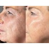 Maani essence Vitamin C Hyaluronic Acid Peptide Wrinkle SERUM face