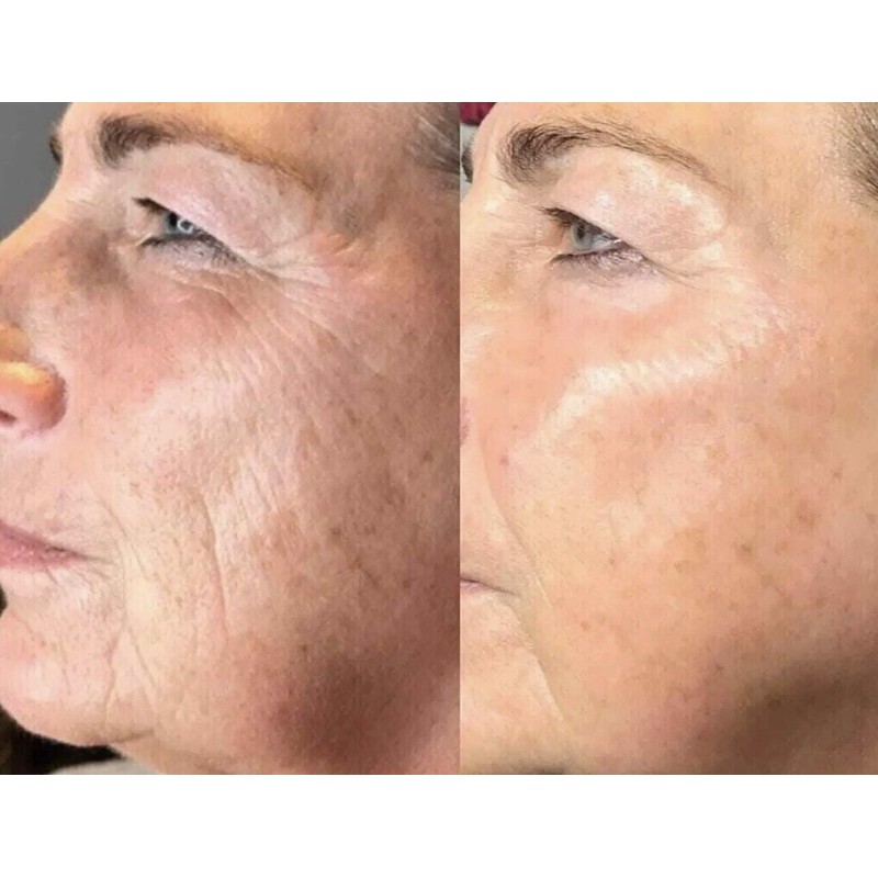 Maani essence Vitamin C Hyaluronic Acid Peptide Wrinkle SERUM face