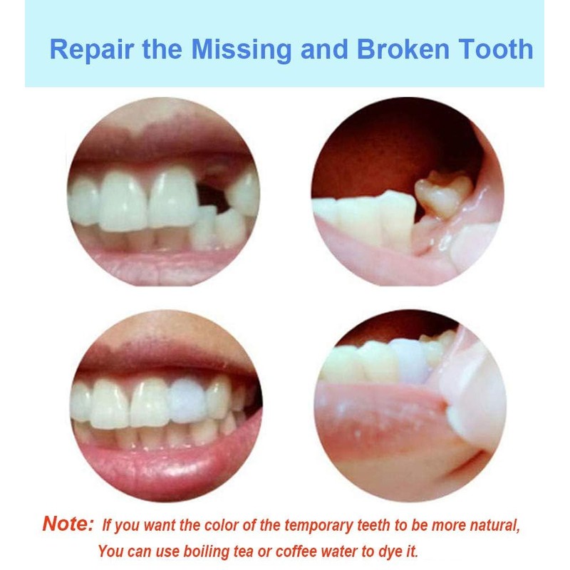 Tooth Filling Thermal Beads Do it Yourself Moldable False Teeth