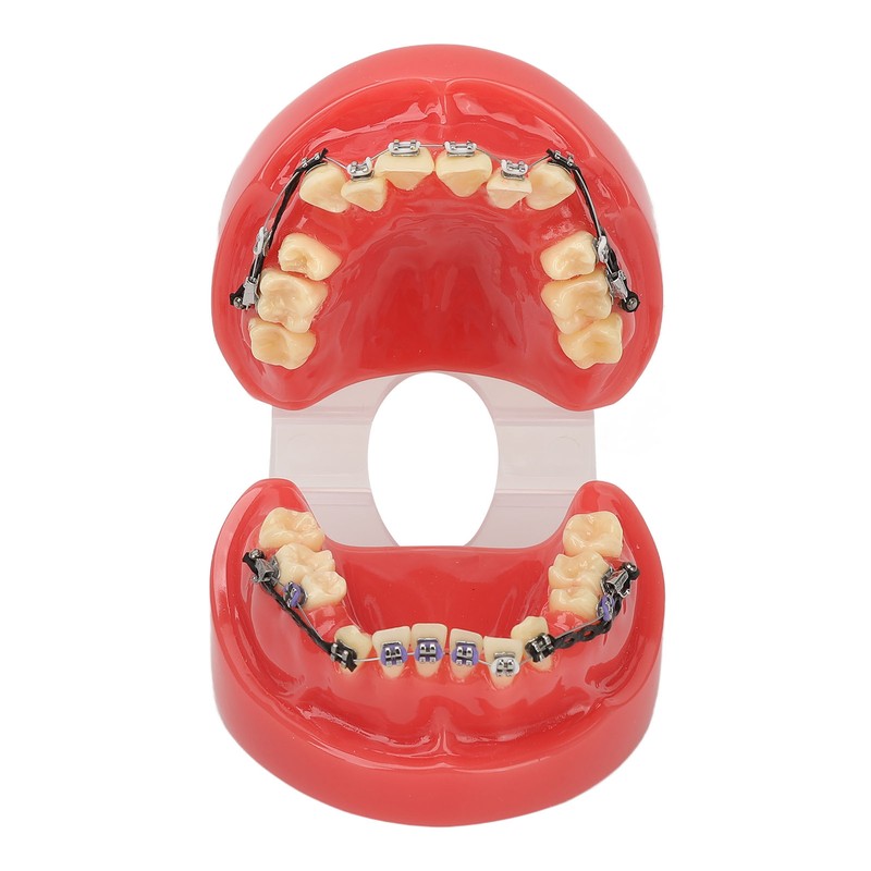 Professional Dental Demonstration Orthodontic Model with Metal Wires and Bracket