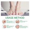 M Jaysuing Tratamiento Hongos De Uñas Herbal 30ml Neutra