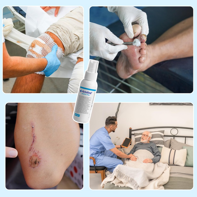 ACTOLIND Solution Plus Wound Rinse Solution I Cleansing, Rinsing and