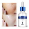 Acido Hialuronico Puro Con Concentrado B5 Rorec Serum Regene Tipo