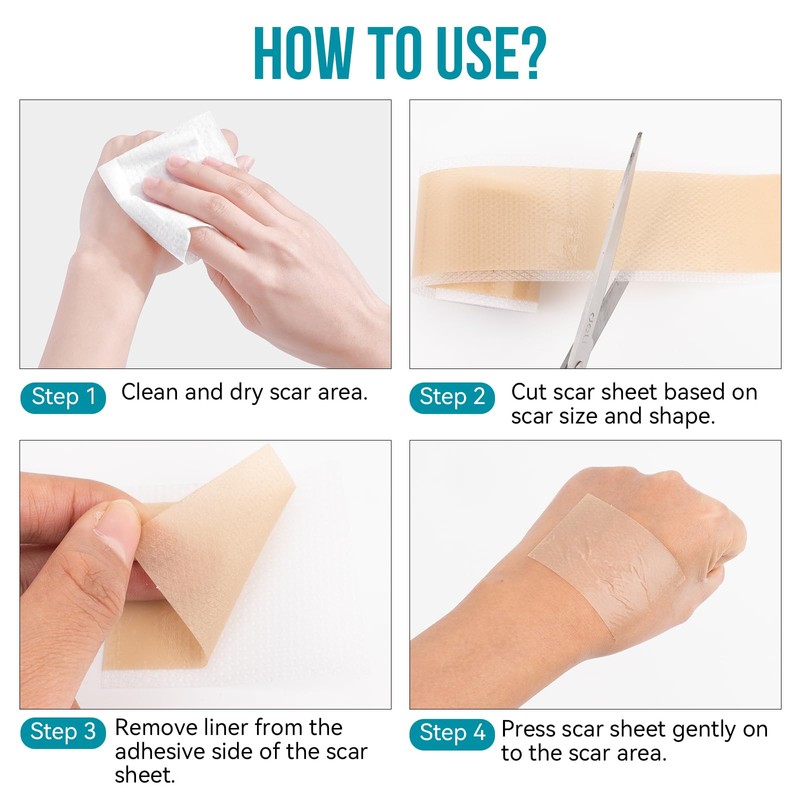 Silikonband für Narben, 300 cm, wiederverwendbar und waschbar, hautfarben