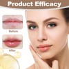 Lip Butter Balm, Conditioning Lip Mask for Instant Moisture,Lip Balm