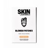 Slick Gorilla Pimple Patches for Men & Teens, 36 Hydrocolloid