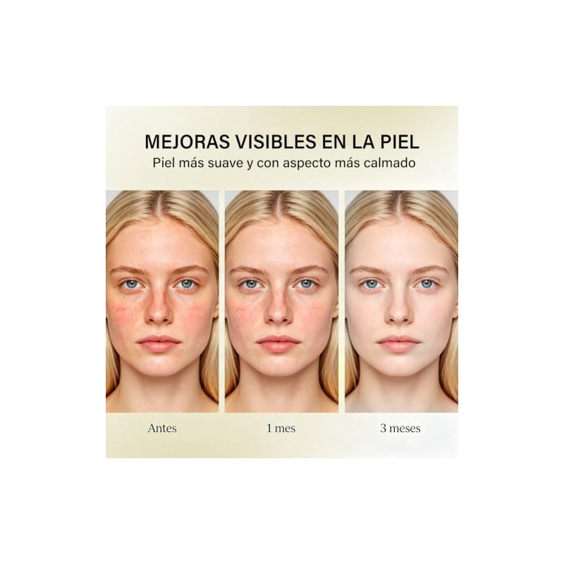Ácido Azelaico al 10% Crema Facial, 50g