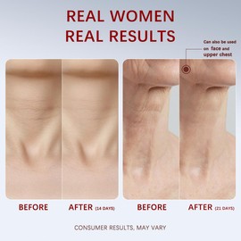 Neck Firming Cream, Anti-Aging Tightening And Lifting Treatment With Peptides, Retinol, Collagen & Hyaluronic Acid Cream For Neck, Face and Chest (1.7 Fl Oz)