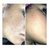 Urban Skin Rx 3-in-1 Clear Skin Cleansing Bar - 2.0oz