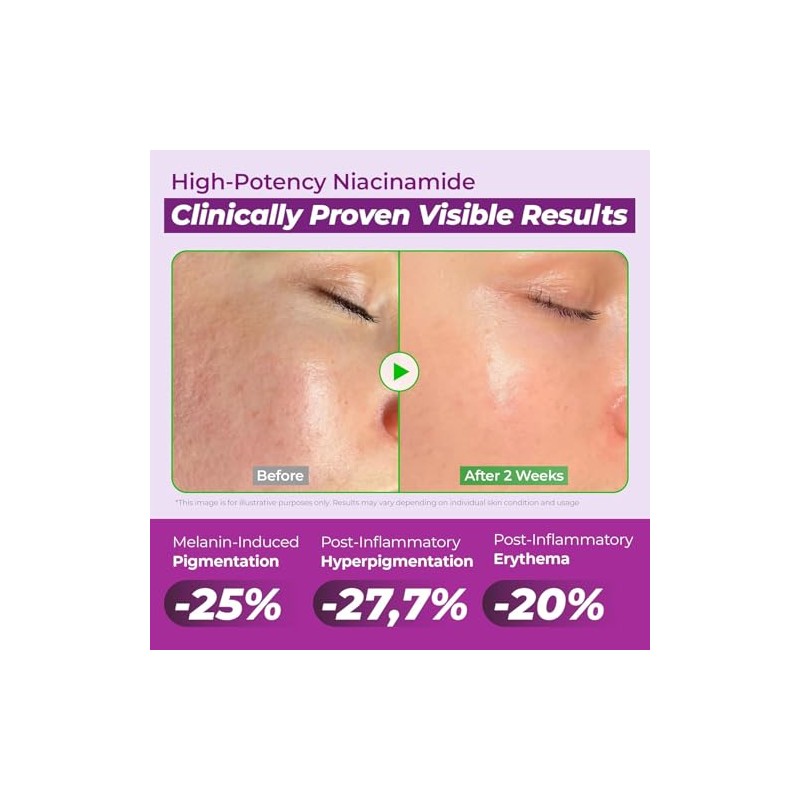 JUMISO Niacinamide 20 Serum - Korean Face Serum with Glutathione,