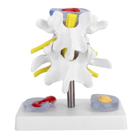 Human Lumbar Vertebrae Model, Skeleton Model Lumbar Vertebrae Model with Detachable Base Excellent Way to demonstrate The disc