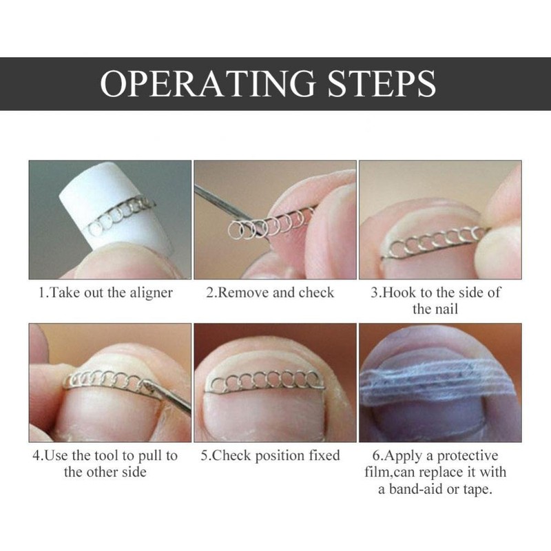 Nail Corrector Pedicure ment Foot Care Tool, 12Pcs/Box Toenail Correction