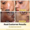 Gleamin Vitamin C Clay Mask for Dark Spots 2.5oz Brightening