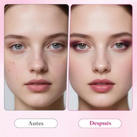 7.0 + TXA 4.0.CREAM Crema de manchas faciales,Arbutin 7.0 + Txa 4.0 Cream,Crema Manchas，Crema de aclaramiento de la piel,manchas oscuras, pecas，pigmen