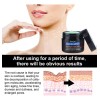 Ee Crema Anti Arrugas Cara, Cuello Pecho, Elimina Manchas