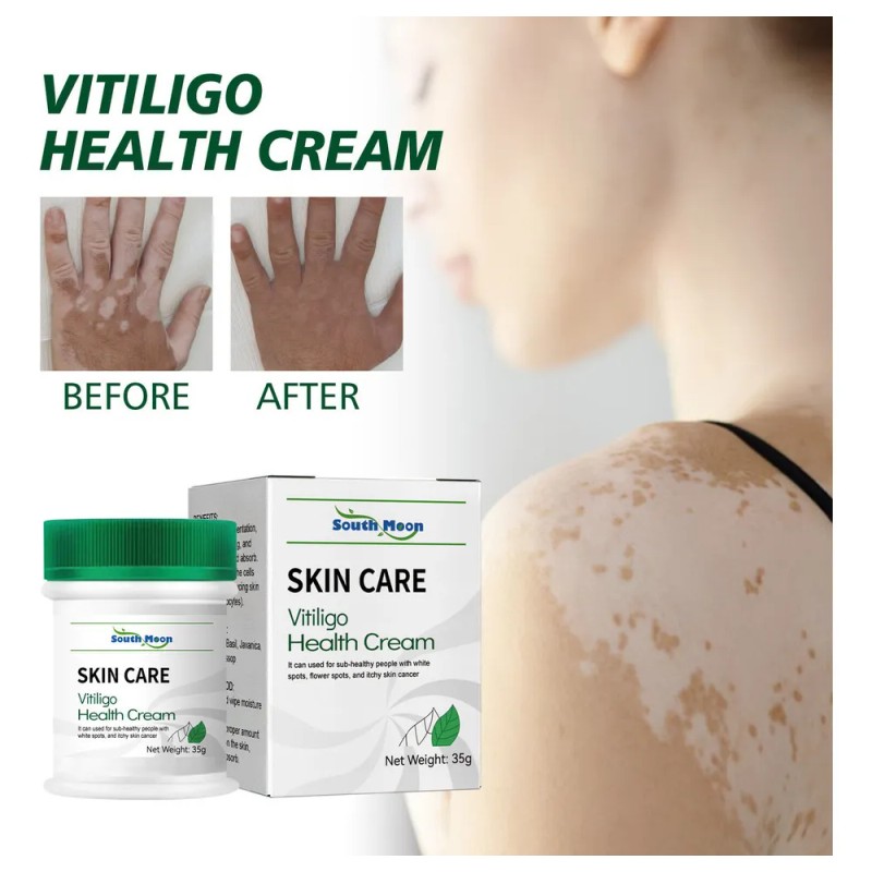 Vitíligo Aceite White Vitíligo Para 4×crema T