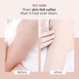 KP Bump Eraser Body Scrub con 10% AHA BHA para cabello encarnado, queratosis pilaris, tratamiento de golpes, exfoliante corporal exfoliante facial par
