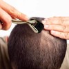 Dermaroller MEESTORY Titanio 0.25mm Microagujas 540 Agujas Facial Barba