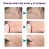 Dermfree Crema Reparadora Cicatriz Profunda 20 G/0.7oz