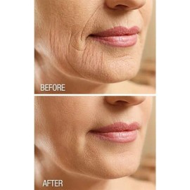 Crema Reafirmante Exfoliante Cuerpo Dermactin Frutal Suave Botella Todas
