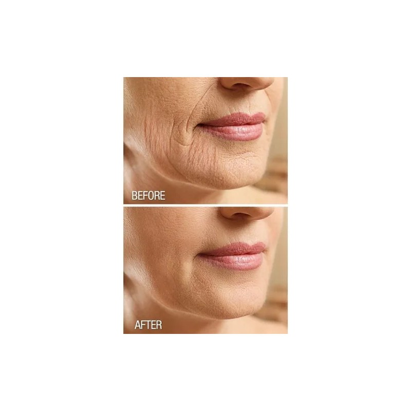 Crema Reafirmante Exfoliante Cuerpo Dermactin Frutal Suave Botella Todas