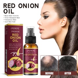 OUHOE Ouhoe Red Onion Hair Oil for Hair Regrowth, Ouhoe Onion Oil for Hair Growth Anti Hair Fall for Shine & Strength, Red Onions Spray for Healthier Hair, Natural Herbs, Extracts & Oils (3pc)