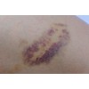 Arnica Bruise Cream Arnica Oil for Bruising Arnica Massage Oil