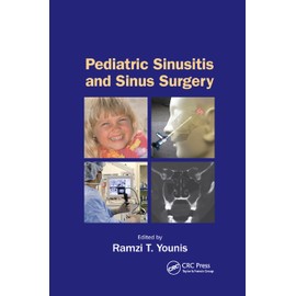 Pediatric Sinusitis and Sinus Surgery