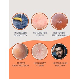 CAUSEHUMAN Penile heal cream for phimosis, redness, dryness, and scarring of skin | Prevents Irritation | Phimosis Cream | Restores and Moisturizes skin | 100 ml (3.38 fl oz) | 60 days supply