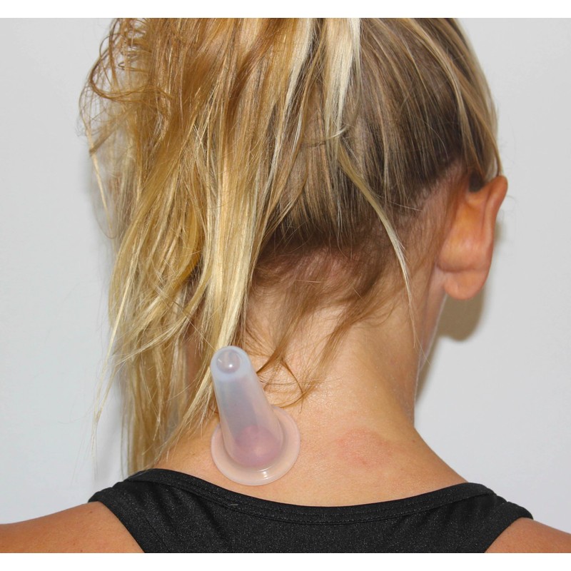 Cupping Kit for Massage Therapy - by DoSensePro, Cupping Set