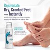 FOOTLOGIX DD Cream Mousse, blanco, 4.23 onzas