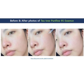 Dr.Ceuracle Tea Tree Purifine Essence - Mild Facial Serum for Sensitive Skin, Redness and Sebum Reducing Korean Skin Care (50ml / 1.69 fl. oz.)