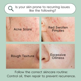 BeauBase Tea Tree Oil Facial Care Kit - Cleanser, Facial Toner, Serum, Cream & Gel for Acne, Blackheads & Excess Sebum