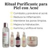Kit Purificante Acné Lilo Skincare Niacinamida Y Retinol