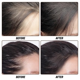 AFGHOUZ Hairline Powder, Root Touch Up Hair Color Powder, Waterproof Hairline and Brow Filler, Cover Up Conceal Gray Thinning Hair for Women Man