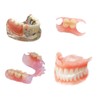 Womcare Do It Yourself Fake Tooth Repair Kits for Making