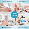Laser Para Quitar Hongos De Las Uñas. Onicomicosis. Blanco