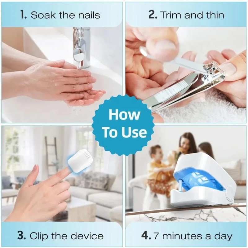 Laser Para Quitar Hongos De Las Uñas. Onicomicosis. Blanco