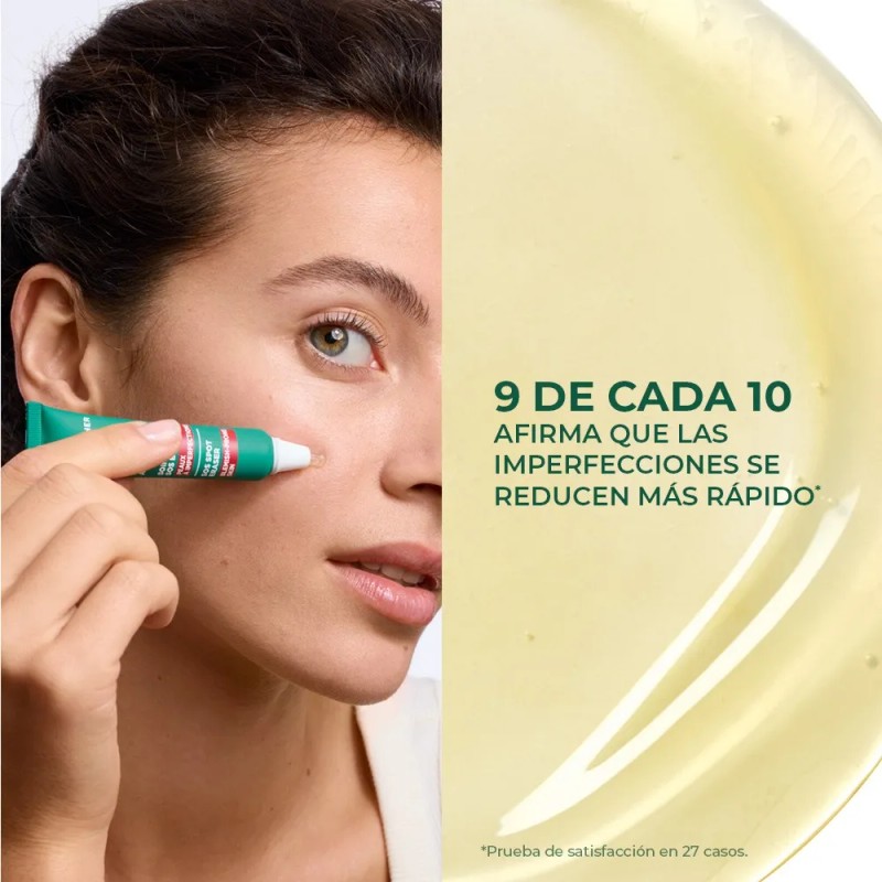 Gel Facial Reductor De Granos D Acné Pure System Yves