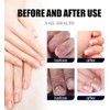 Ginger Nail, Tratamiento de Uñas con Jengibre, Soporte para Uñas,
