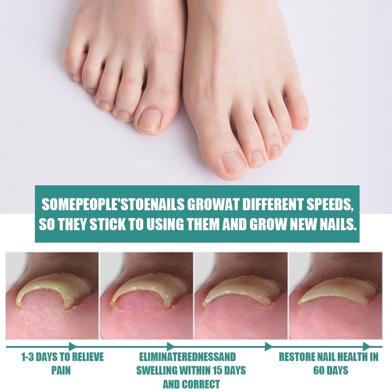 60 Pieces Painless Toenail Smoothing Strips with Nail Remover +