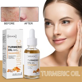 Turmeric Dark Spot Corrector Serum, 2022 New Natural Turmeric Repair Face Serum, Facial Moisturising Essence, Bright Skin Dark Spot Corrector Face Whitening Serum