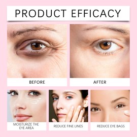 Pack of 2 Jasmine Ointment Eyes 100 g, Active Jasmine Ointment Plus for Dark Circles, Eye Fatigue and Swelling as Saggy Eyelids, Eye Care for Women and Men (2)