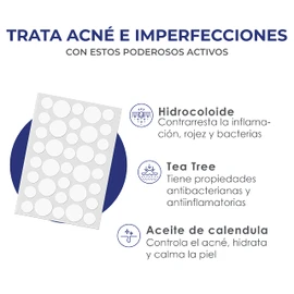 MIST JEWEL Parches para acne hidrocoloides con Tea tree y Caléndula | Patch para granos e imperfecciones y pimple reduce enrojecimiento, inflamación y protege la piel efecto inmediato 180 parches