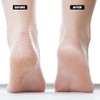 Moisturizing Socks Lotion Gel for Dry Cracked Heels 4 Pack,