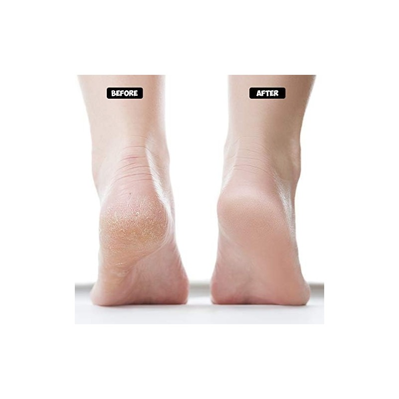 Moisturizing Socks Lotion Gel for Dry Cracked Heels 4 Pack,
